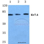 Anti-Kv7.4 Antibody from Bioworld Technology (BS5773) - Antibodies.com