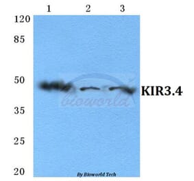 Anti-KIR3.4 Antibody from Bioworld Technology (BS5775) - Antibodies.com