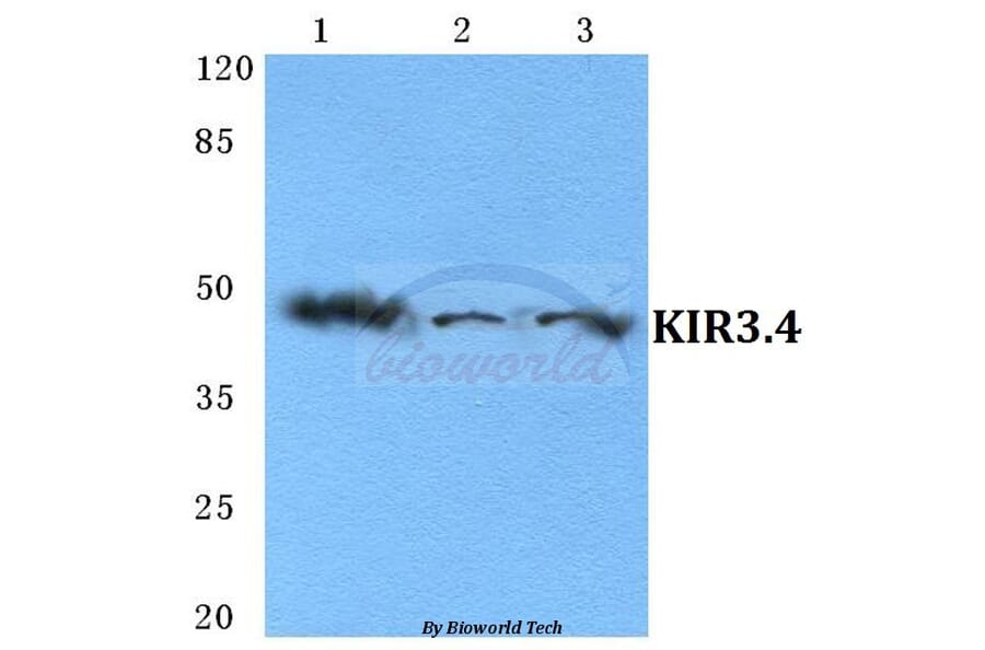 Anti-KIR3.4 Antibody from Bioworld Technology (BS5775) - Antibodies.com