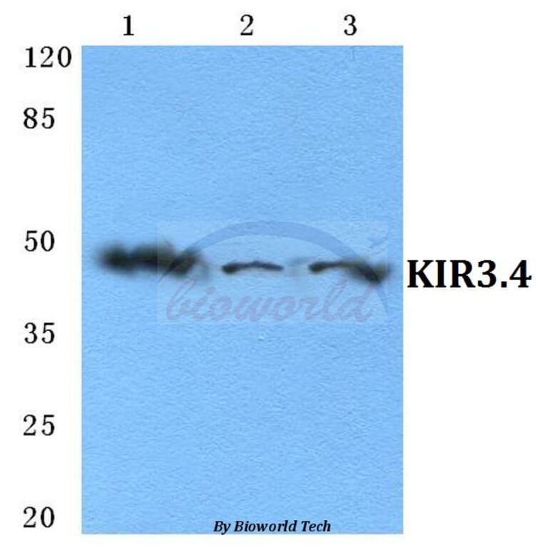 Anti-KIR3.4 Antibody from Bioworld Technology (BS5775) - Antibodies.com