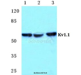 Anti-Kv1.1 Antibody from Bioworld Technology (BS5777) - Antibodies.com