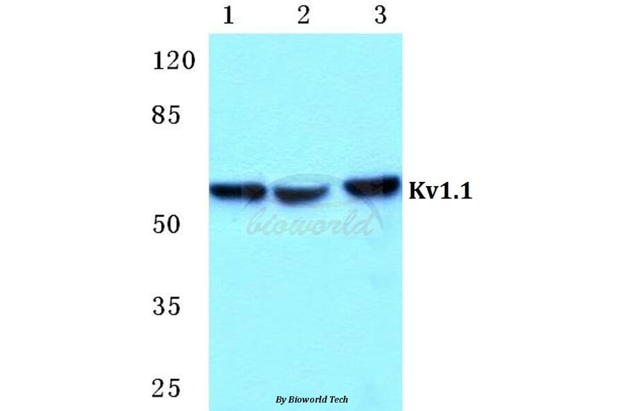 Anti-Kv1.1 Antibody from Bioworld Technology (BS5777) - Antibodies.com