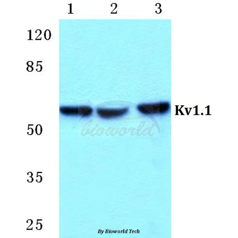 Anti-Kv1.1 Antibody from Bioworld Technology (BS5777) - Antibodies.com