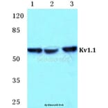 Anti-Kv1.1 Antibody from Bioworld Technology (BS5777) - Antibodies.com