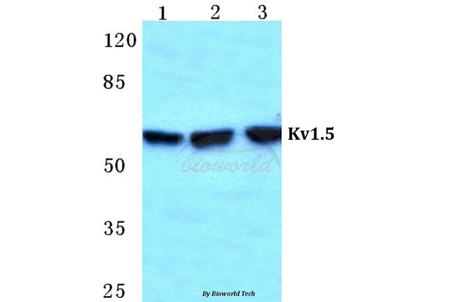 Anti-Kv1.5 Antibody from Bioworld Technology (BS5778) - Antibodies.com