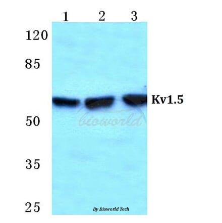 Anti-Kv1.5 Antibody from Bioworld Technology (BS5778) - Antibodies.com