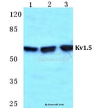 Anti-Kv1.5 Antibody from Bioworld Technology (BS5778) - Antibodies.com