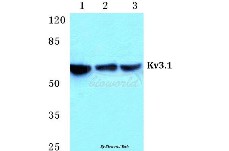 Anti-Kv3.1 Antibody from Bioworld Technology (BS5779) - Antibodies.com