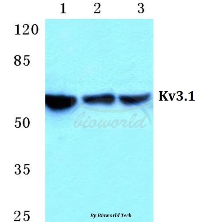 Anti-Kv3.1 Antibody from Bioworld Technology (BS5779) - Antibodies.com