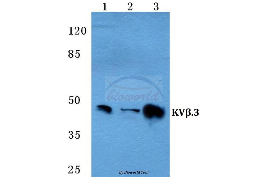 Anti-KVβ.3 Antibody from Bioworld Technology (BS5780) - Antibodies.com