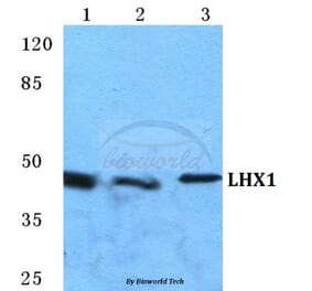 Anti-LHX1 Antibody from Bioworld Technology (BS5782) - Antibodies.com