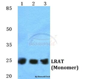 Anti-LRAT Antibody from Bioworld Technology (BS5783) - Antibodies.com