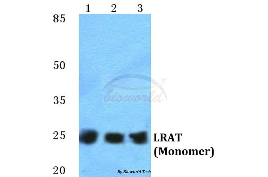 Anti-LRAT Antibody from Bioworld Technology (BS5783) - Antibodies.com