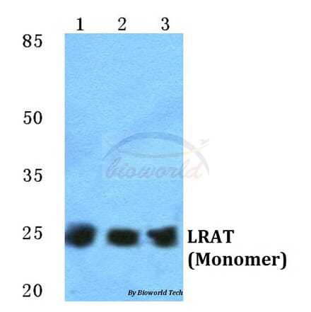 Anti-LRAT Antibody from Bioworld Technology (BS5783) - Antibodies.com