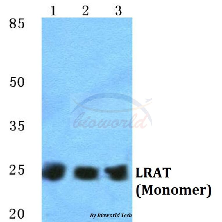 Anti-LRAT Antibody from Bioworld Technology (BS5783) - Antibodies.com