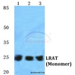 Anti-LRAT Antibody from Bioworld Technology (BS5783) - Antibodies.com