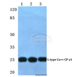 Anti-CACNG1 Antibody from Bioworld Technology (BS5785) - Antibodies.com