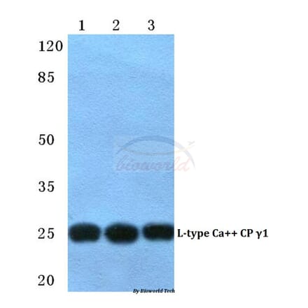 Anti-CACNG1 Antibody from Bioworld Technology (BS5785) - Antibodies.com