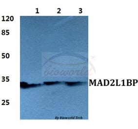 Anti-MAD2L1BP Antibody from Bioworld Technology (BS5788) - Antibodies.com