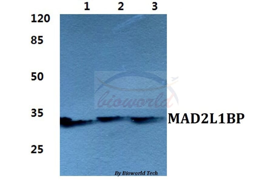 Anti-MAD2L1BP Antibody from Bioworld Technology (BS5788) - Antibodies.com
