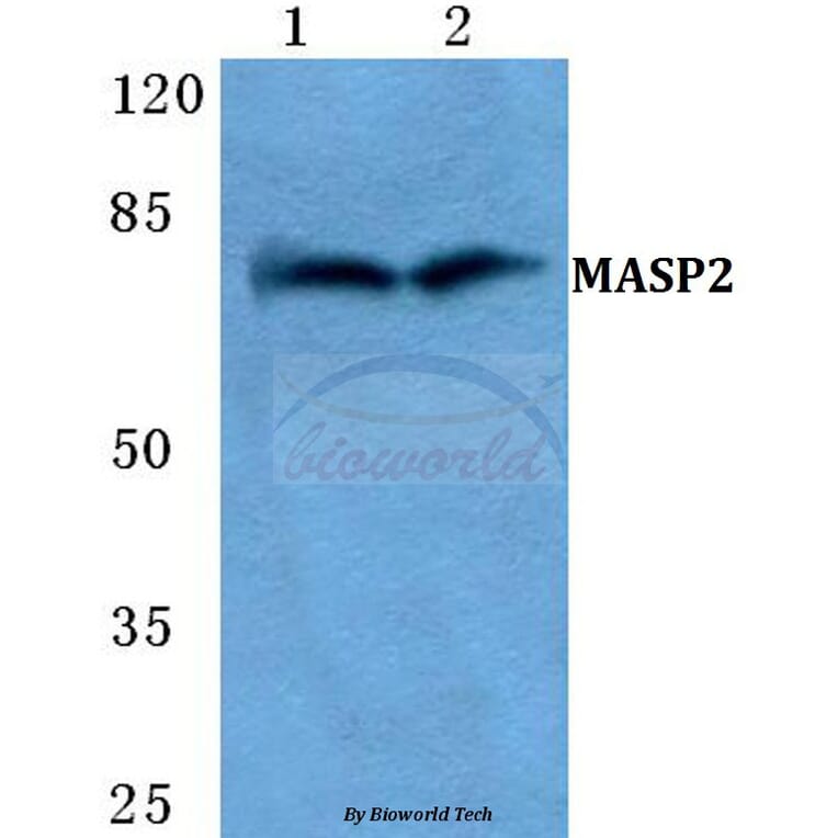 Anti-MASP2 Antibody from Bioworld Technology (BS5789) - Antibodies.com