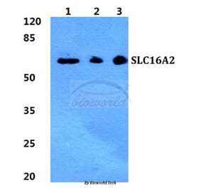 Anti-SLC16A2 Antibody from Bioworld Technology (BS5793) - Antibodies.com