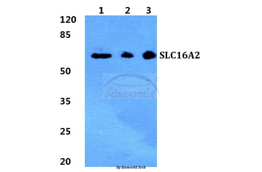 Anti-SLC16A2 Antibody from Bioworld Technology (BS5793) - Antibodies.com