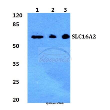 Anti-SLC16A2 Antibody from Bioworld Technology (BS5793) - Antibodies.com