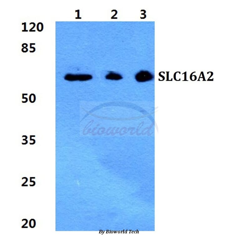 Anti-SLC16A2 Antibody from Bioworld Technology (BS5793) - Antibodies.com