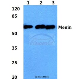 Anti-Menin Antibody from Bioworld Technology (BS5795) - Antibodies.com