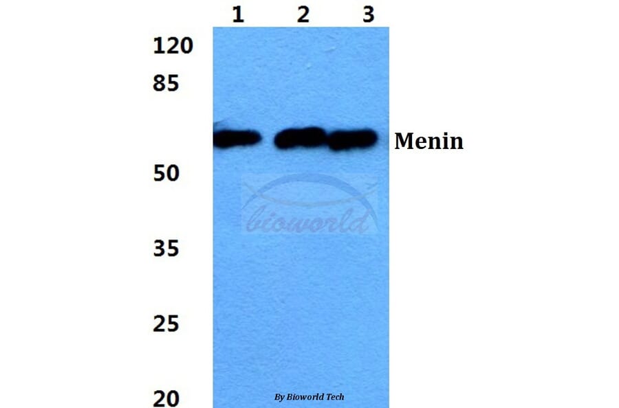 Anti-Menin Antibody from Bioworld Technology (BS5795) - Antibodies.com
