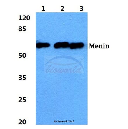 Anti-Menin Antibody from Bioworld Technology (BS5795) - Antibodies.com