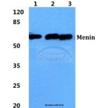 Anti-Menin Antibody from Bioworld Technology (BS5795) - Antibodies.com