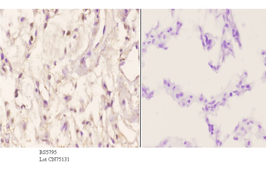 Anti-Menin Antibody from Bioworld Technology (BS5795) - Antibodies.com