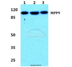 Anti-MPP9 Antibody from Bioworld Technology (BS5800) - Antibodies.com