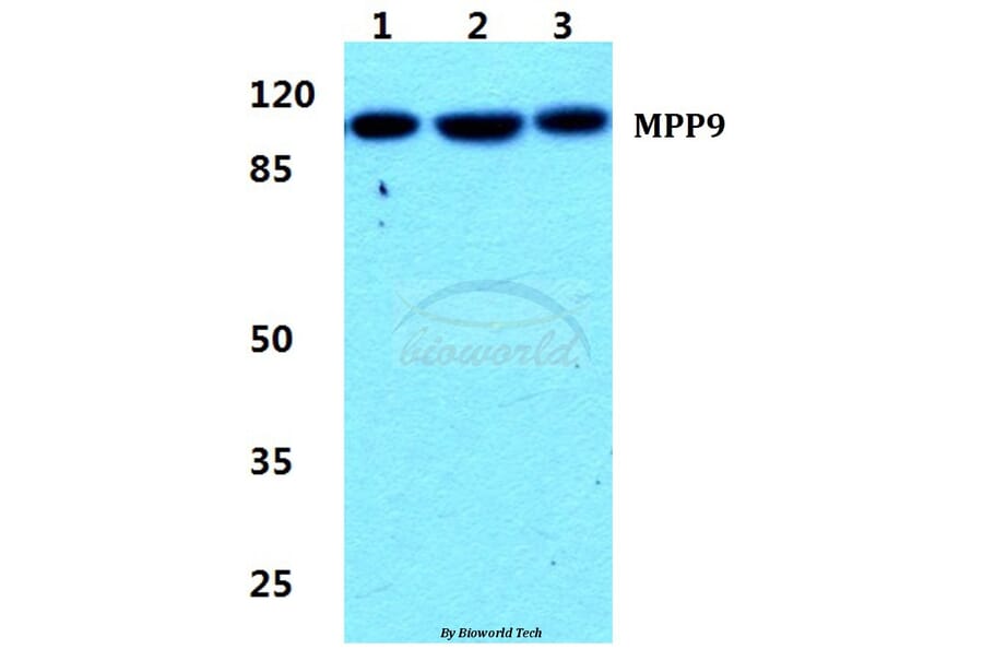 Anti-MPP9 Antibody from Bioworld Technology (BS5800) - Antibodies.com