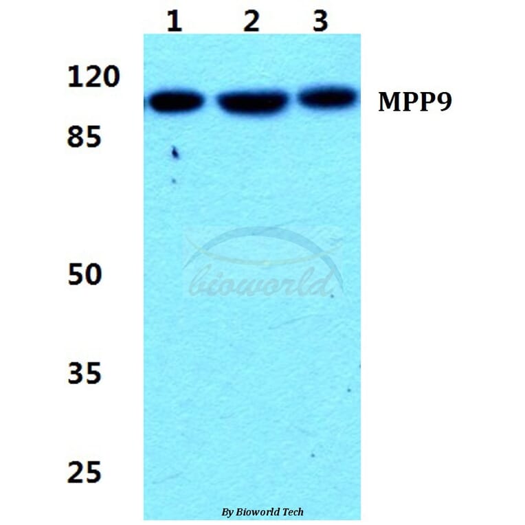 Anti-MPP9 Antibody from Bioworld Technology (BS5800) - Antibodies.com