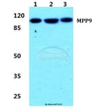Anti-MPP9 Antibody from Bioworld Technology (BS5800) - Antibodies.com
