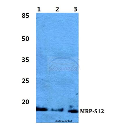 Anti-MRP-S12 Antibody from Bioworld Technology (BS5803) - Antibodies.com