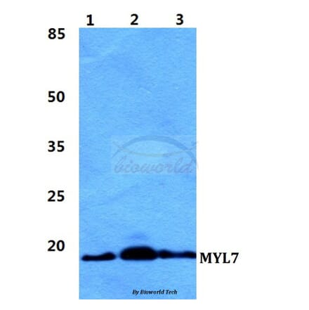 Anti-MYL7 Antibody from Bioworld Technology (BS5808) - Antibodies.com