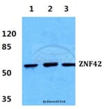 Anti-ZNF42 Antibody from Bioworld Technology (BS5810) - Antibodies.com