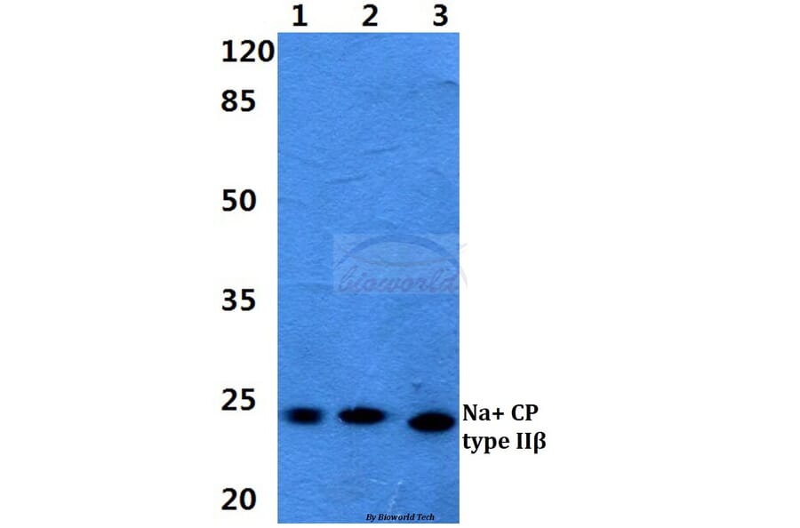 Anti-Na+ CP type IIβ Antibody from Bioworld Technology (BS5811) - Antibodies.com