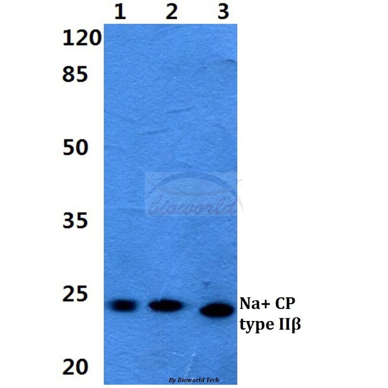 Anti-Na+ CP type IIβ Antibody from Bioworld Technology (BS5811) - Antibodies.com