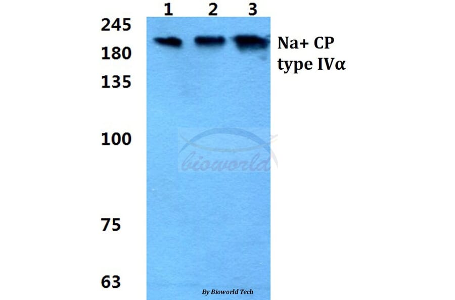 Anti-Na+ CP type IVα Antibody from Bioworld Technology (BS5812) - Antibodies.com
