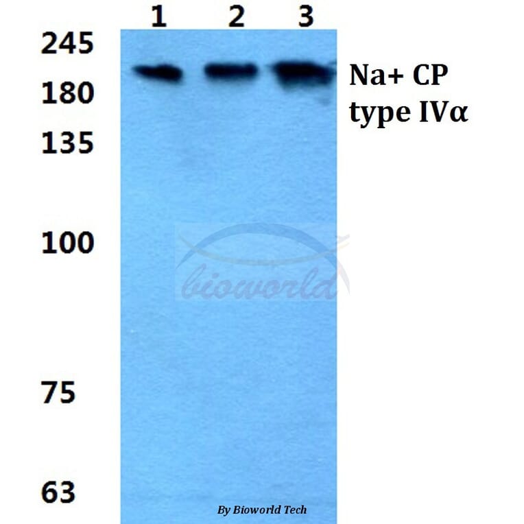 Anti-Na+ CP type IVα Antibody from Bioworld Technology (BS5812) - Antibodies.com
