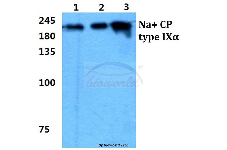 Anti-Na+ CP type IXα Antibody from Bioworld Technology (BS5813) - Antibodies.com