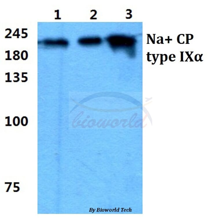 Anti-Na+ CP type IXα Antibody from Bioworld Technology (BS5813) - Antibodies.com