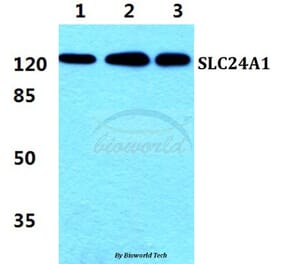 Anti-SLC24A1 Antibody from Bioworld Technology (BS5815) - Antibodies.com