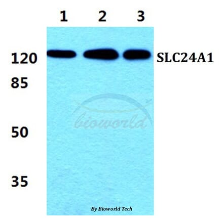 Anti-SLC24A1 Antibody from Bioworld Technology (BS5815) - Antibodies.com