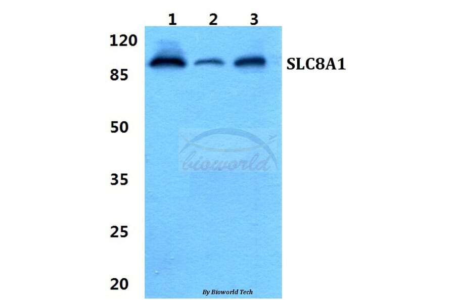Anti-SLC8A1 Antibody from Bioworld Technology (BS5816) - Antibodies.com